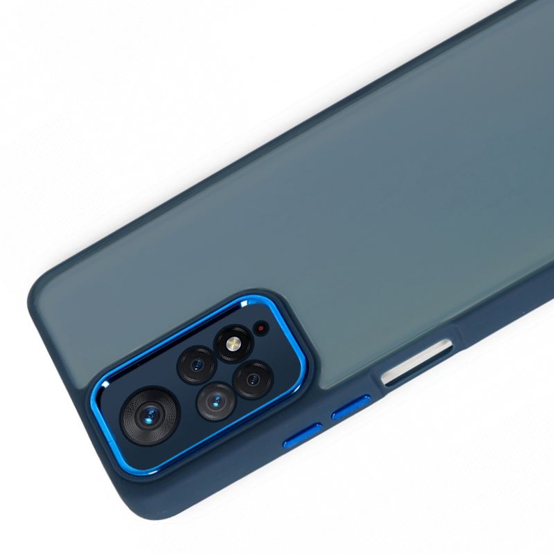 Xiaomi Redmi Note 11 / 11s Kılıf Freya Lazer Lens Kamera Çerçeveli Silikon Kapak